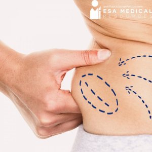 Denver Awake Lip Job